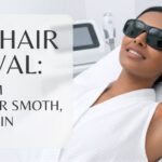 laser hair removal