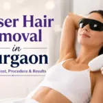 laser hair removal