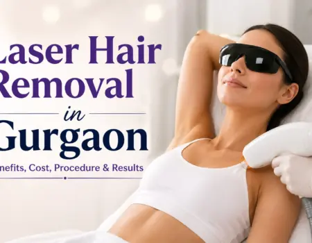 laser hair removal
