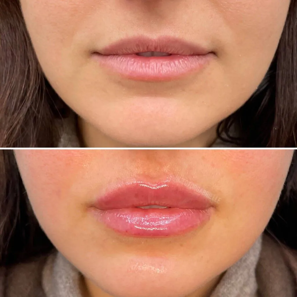Pink booster treatment before and after