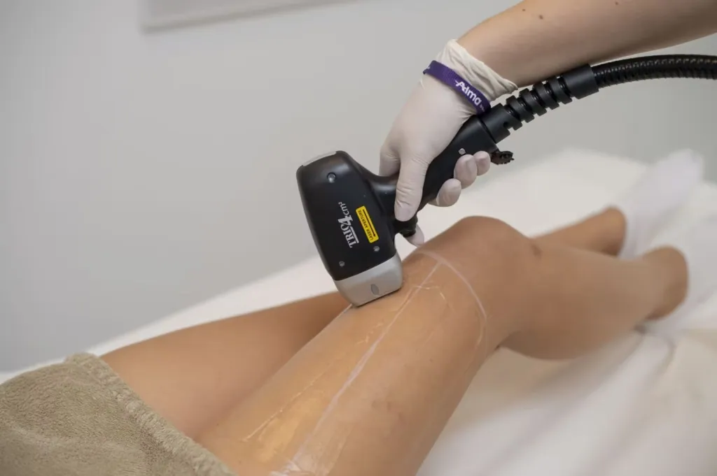 A close-up of a professional performing a safe Bikini Laser Hair Removal treatment with an advanced laser machine.